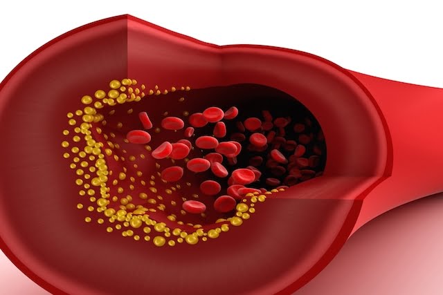  Conozca más sobre el colesterol HDL en la sangre