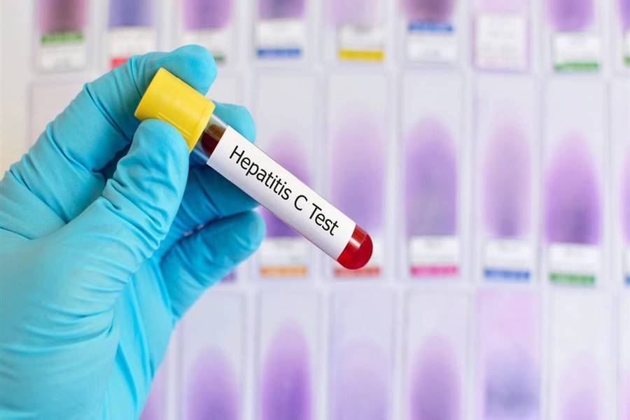 España podría eliminar la Hepatitis C para el 2025